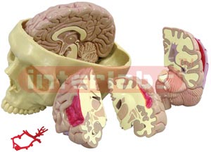 Brain and Partial Skull